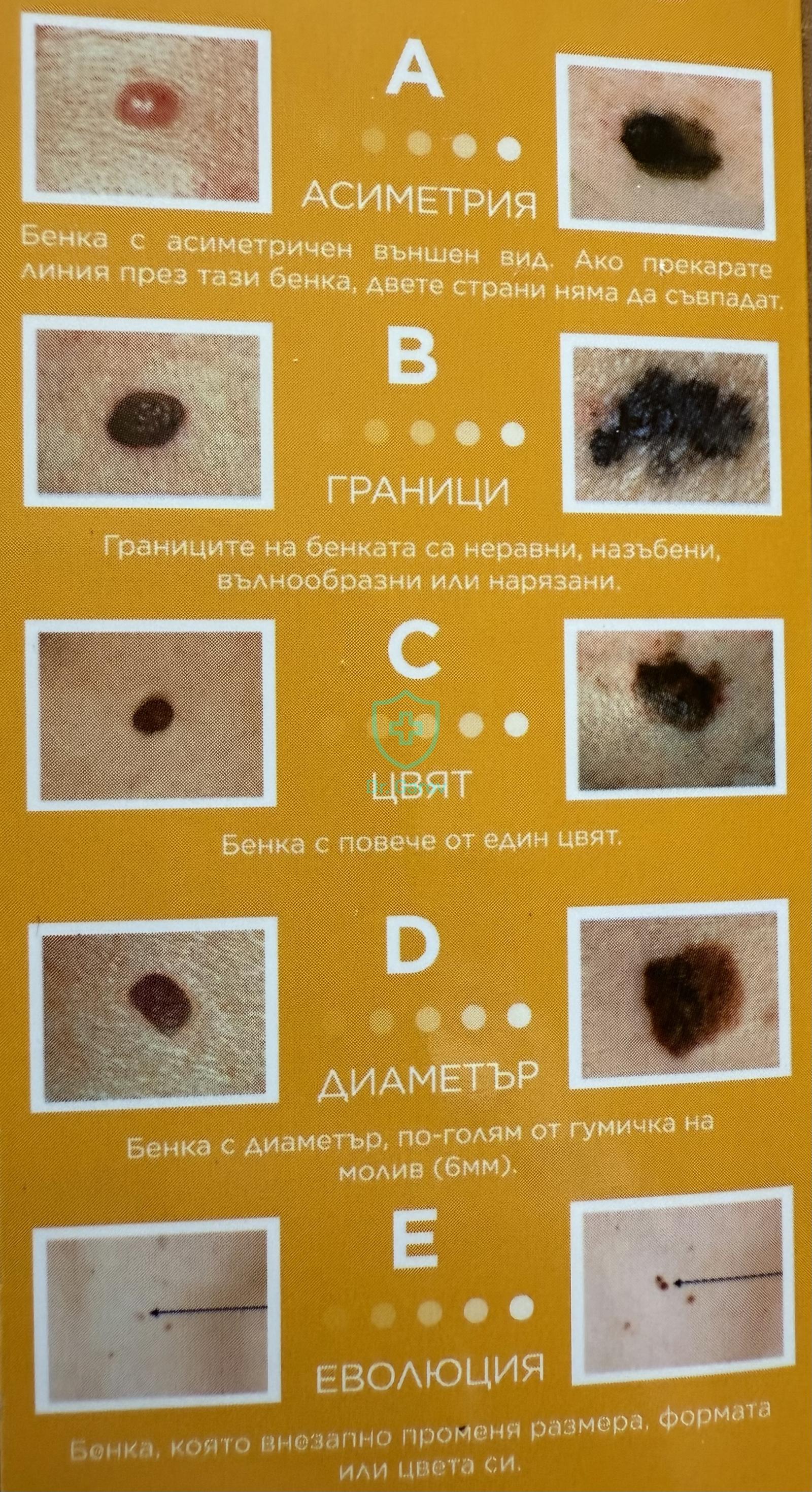 Меланома малигнум